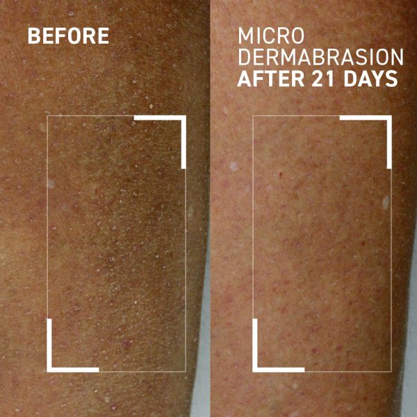 BODY POLISHING EXFOLIATOR Online - Image 2