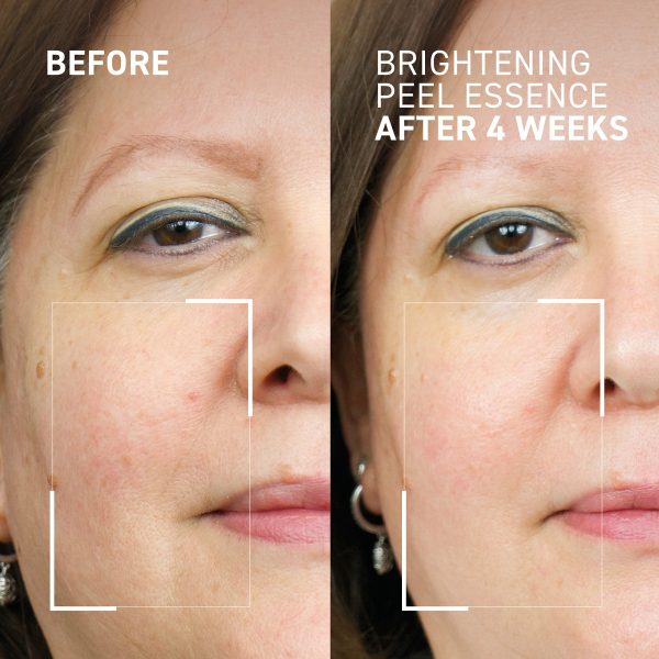 BRIGHTENING PEEL ESSENCE Online Hot Sale - Image 2